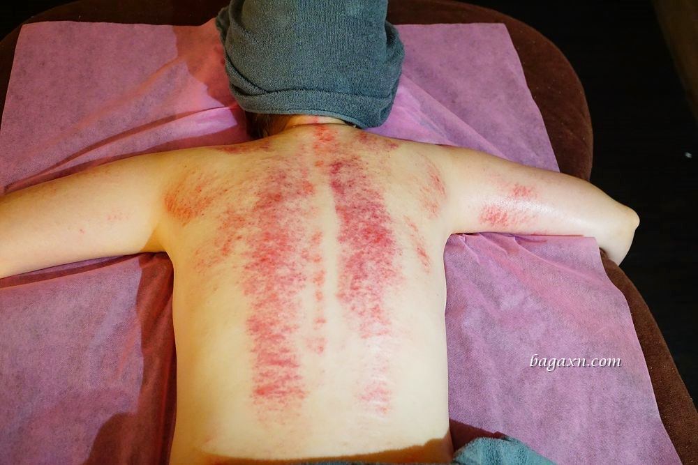 台中西區勤美精油按摩│舒活養生館。手法專業態度親切，按摩刮痧一次享受