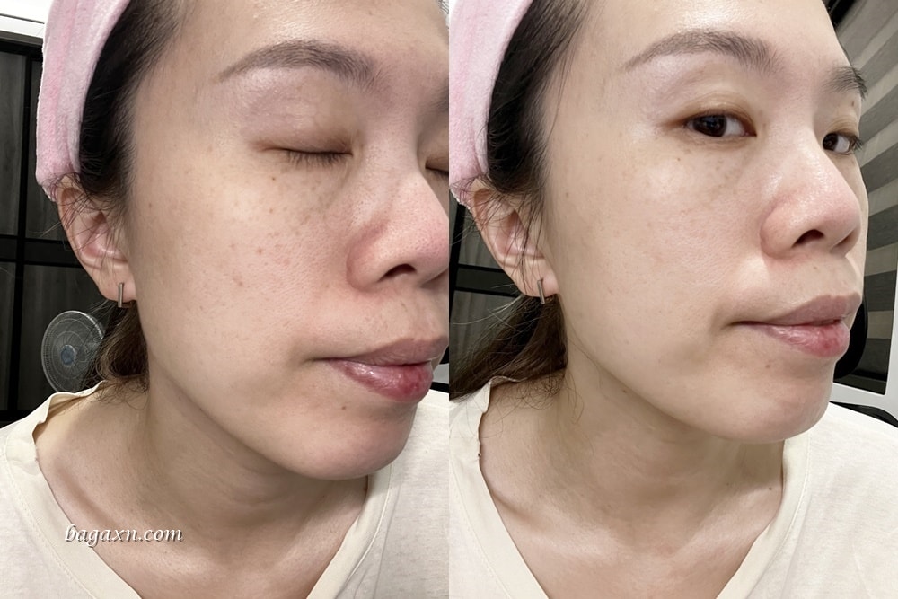 Bb LABORATORIES│日本最新奈米氣泡技術有肌膚拋光水之稱的「杏仁酸奈米柔光煥膚水」