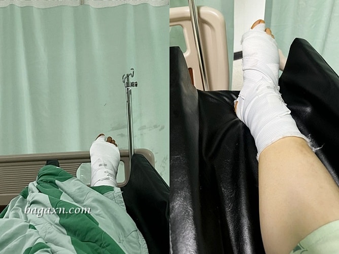 生活│拇指外翻手術心得#1-台北長庚門診及林口長庚住院分享 - 第19張圖 生活│拇指外翻手術心得#1-台北長庚門診及林口長庚住院分享