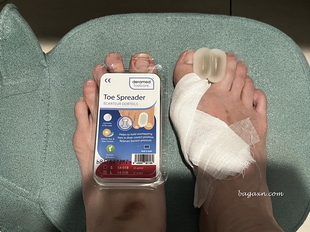 生活│拇指外翻手術心得#2-二週後回診及手術費用分享 - 第12張圖 生活│拇指外翻手術心得#2-二週後回診及手術費用分享