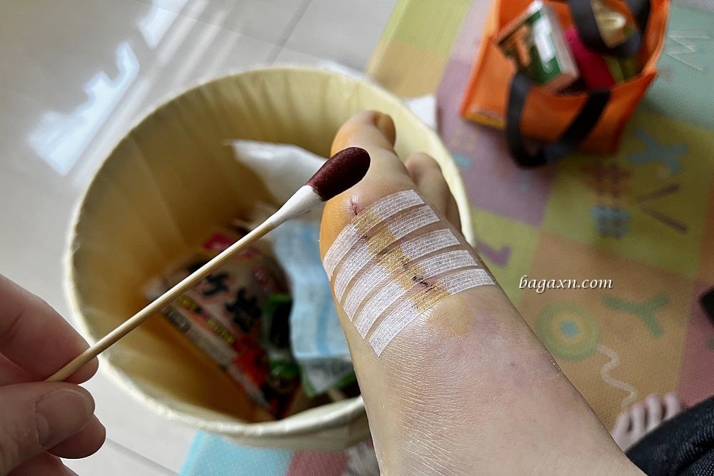 生活│拇指外翻手術心得#2-二週後回診及手術費用分享 - 第3張圖 生活│拇指外翻手術心得#2-二週後回診及手術費用分享