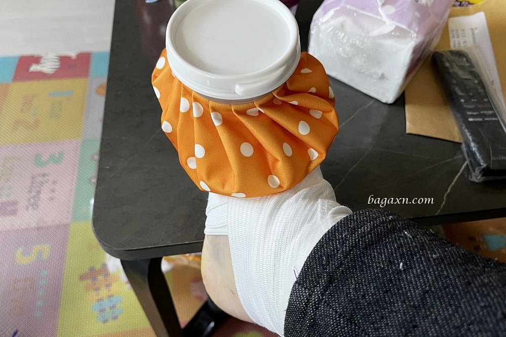 生活│拇指外翻手術心得#2-二週後回診及手術費用分享 - 第8張圖 生活│拇指外翻手術心得#2-二週後回診及手術費用分享