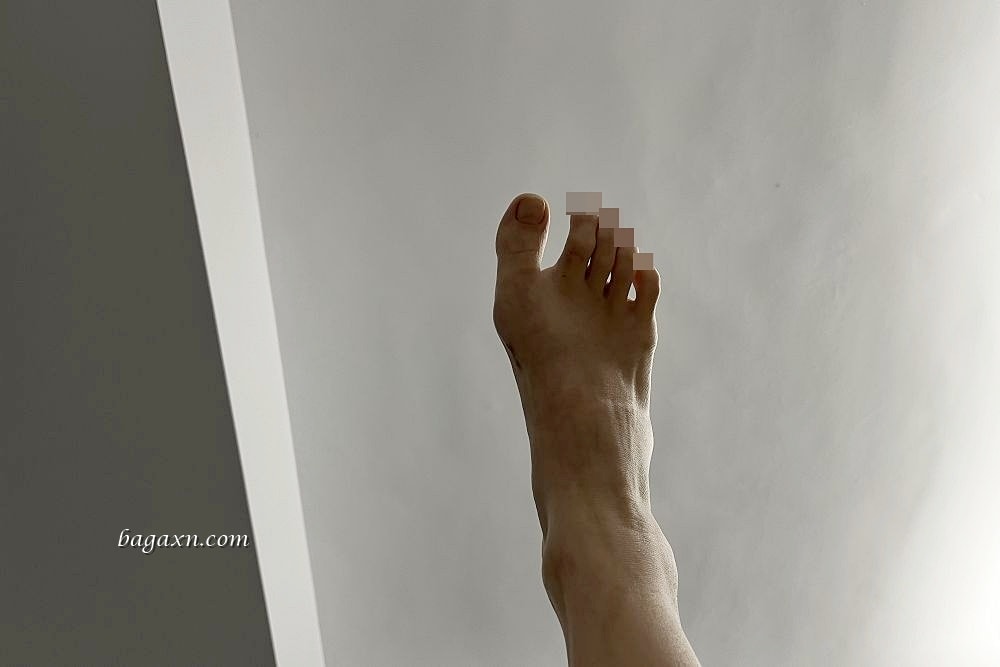 生活│拇指外翻手術心得#3-術後二個月回診及後續分享 - 第9張圖 生活│拇指外翻手術心得#3-術後二個月回診及後續分享